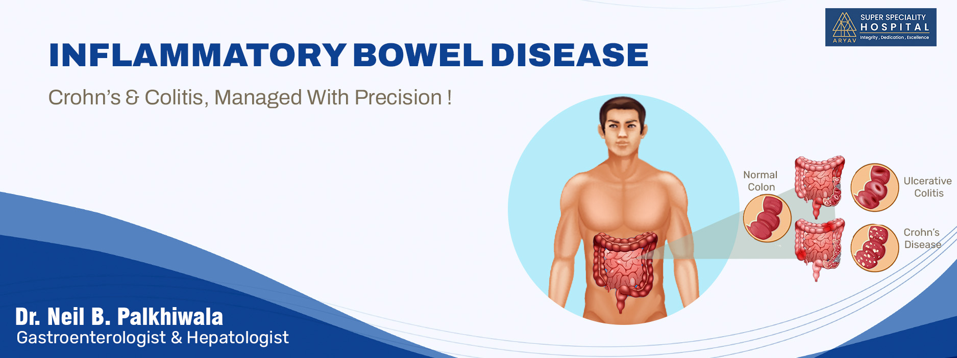 Inflammatory Bowel Disease Treatment